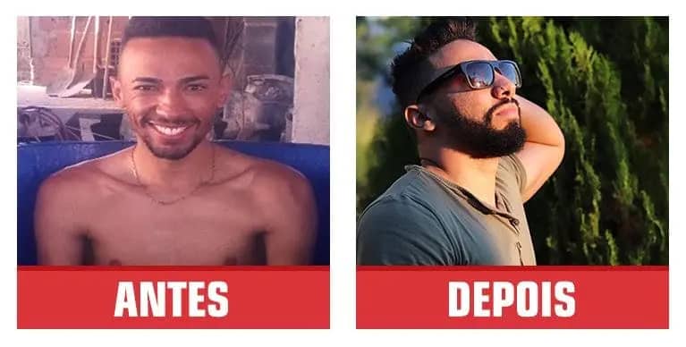 Antes e Depois