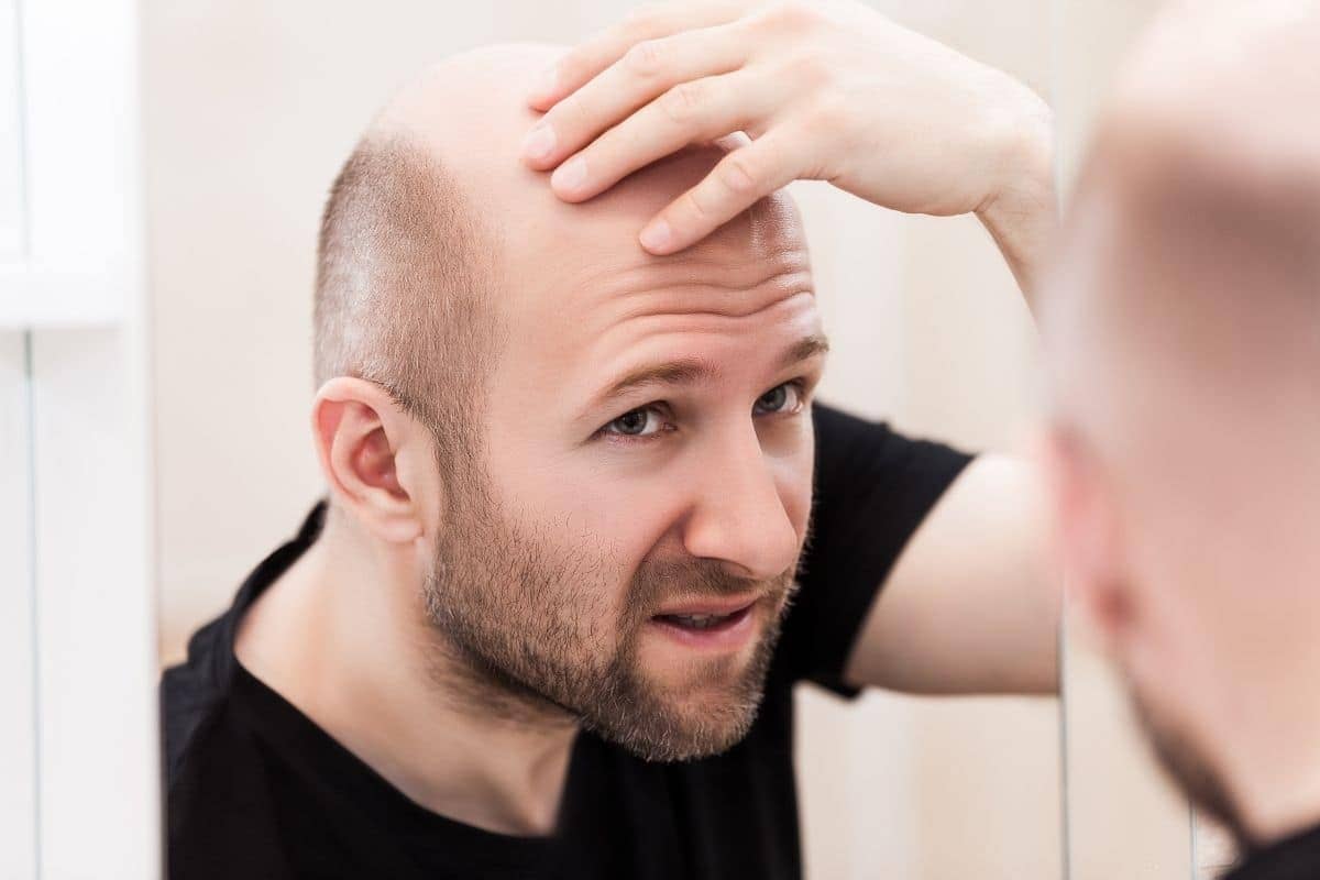 tratamento para queda de cabelo tratamento para queda de cabelo masculino melhor tratamento para queda de cabelo tratamento para calvicie produto para queda de cabelo