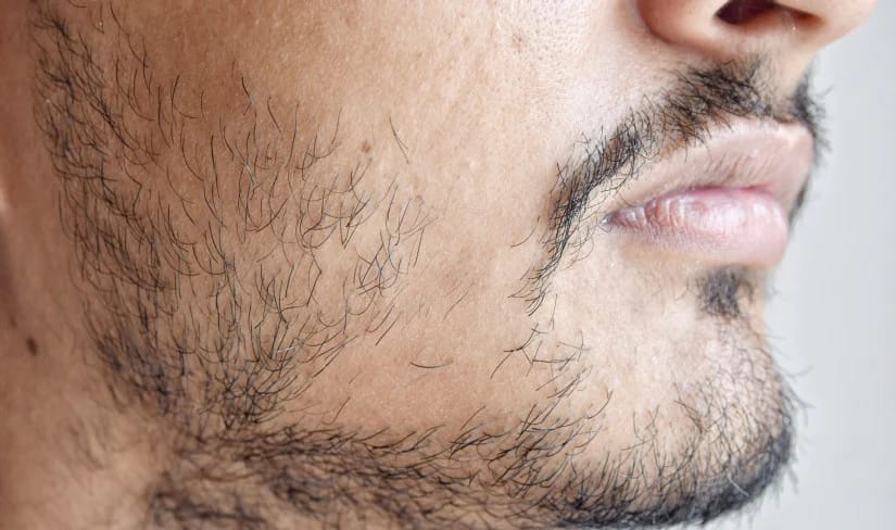 Como Ter Barba: Guia Completo 4 barba falhada