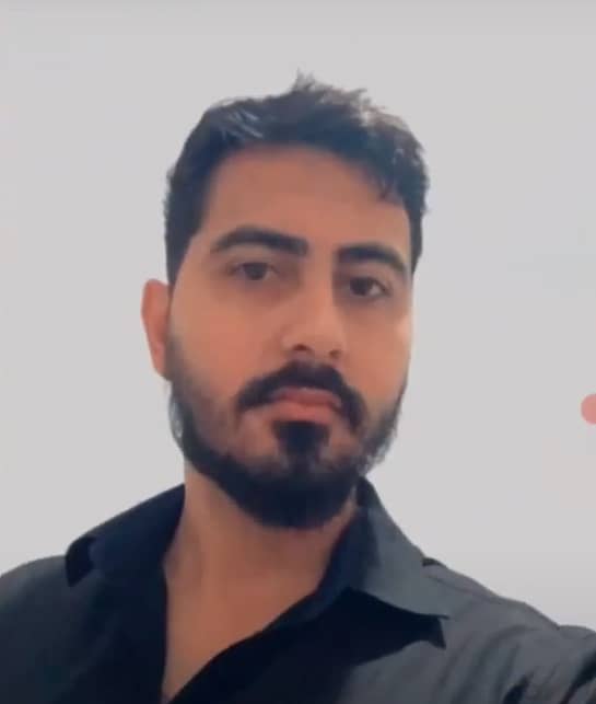 Evolução com Minoxidil: A Inspiradora Jornada de Rodolpho Lopes 3 Evolucao com minoxidil rodolpho 1